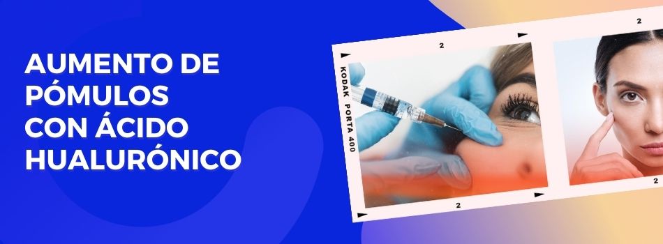 Aumento de pómulos con ácido hialuonico