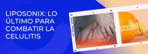 Liposonix