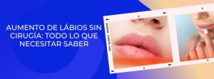 aumento lábios botox