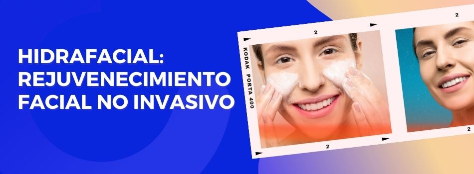 Tratamiento Hidrafacial
